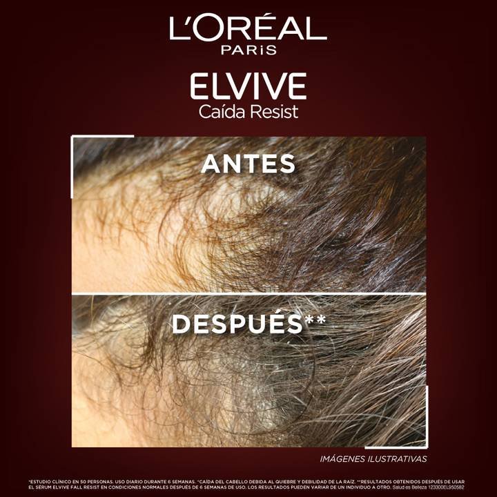 Resultados del Sérum Aminexil Centroamerica. Antes y Después: Cabello más denso y cuero cabelludo menos visible